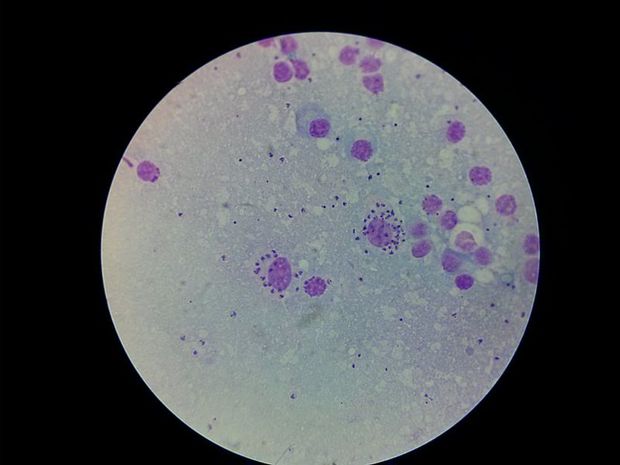 100年前に発見された生体の防御の要「マクロファージ」って何だ?